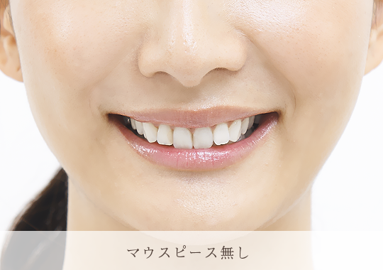 マウスピース無し